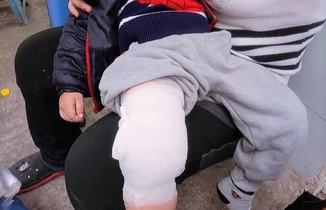 Vụ bé 3 tuổi gãy chân trong lớp ở Hà Nội: Cơ sở mầm non phải đóng cửa từ 14/4