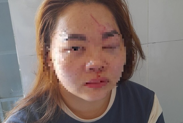 Xem xét kỷ luật thầy giáo đánh vợ phải nhập viện