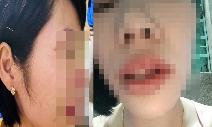 Vụ phụ huynh xông vào nhà đánh cô giáo: UBND tỉnh Đắk Nông chỉ đạo khẩn