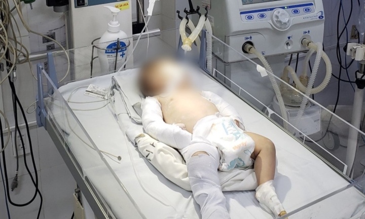 Bé gái 3 tháng tuổi bị người tình của mẹ bạo hành: Sức khỏe giờ ra sao? 