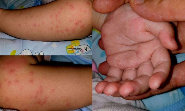 Tin thời sự mới nóng nhất 24/6: Việt Nam sắp có vắc xin phòng bệnh tay chân miệng