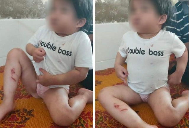 Hà Tĩnh: Bé 4 tuổi nhập viện với nhiều vết thương đáng ngờ, nghi bị bạo hành