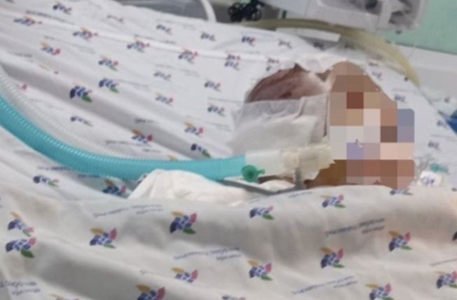 Vụ bảo mẫu bạo hành bé trai 6 tháng tuổi đến xuất huyết não: Do quấy khóc, đi vệ sinh bẩn