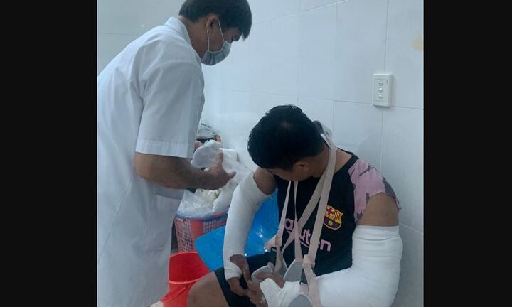 Quảng Ngãi: Hai vợ chồng dùng tuýp sắt, ghế inox đánh gãy hai tay shipper