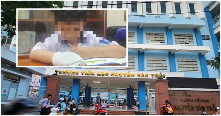 Vụ học sinh bị đánh gãy ngón tay: Kỷ luật nữ giáo viên bằng hình thức cảnh cáo