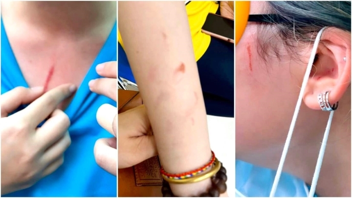 Bộ GD&ĐT chỉ đạo xử  lý vụ học sinh bị bạo lực ở trường quốc tế TP. HCM