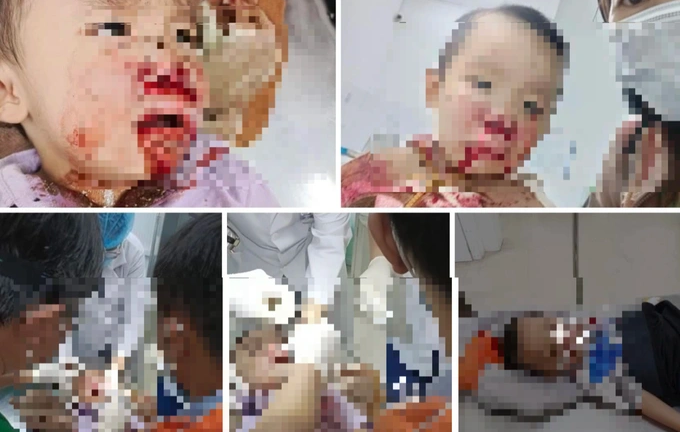 Vụ người mẹ tố CSGT đánh trúng mặt con trai: Phó Giám đốc Công an tỉnh Tiền Giang nói gì?