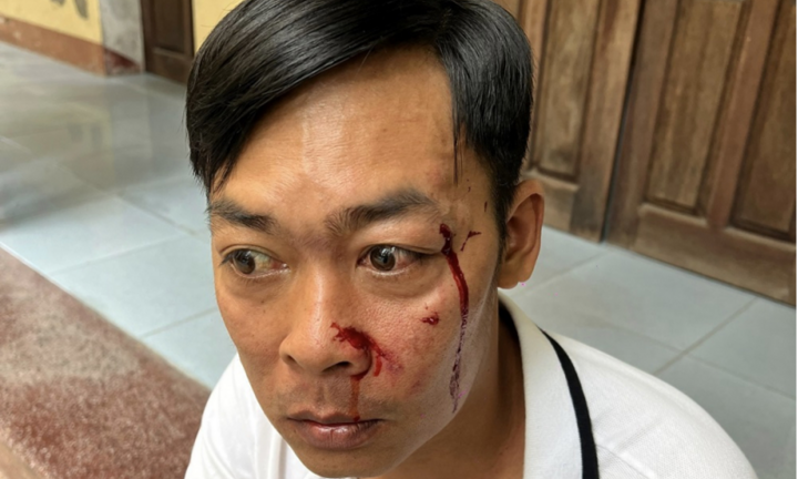 Huế: Xác minh vụ người đàn ông bị hành hung khi vừa rời trụ sở tòa án