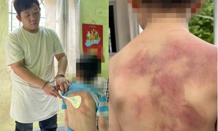 Tạm giữ hình sự người đàn ông ở Đồng Nai hành hạ dã man con trai ruột