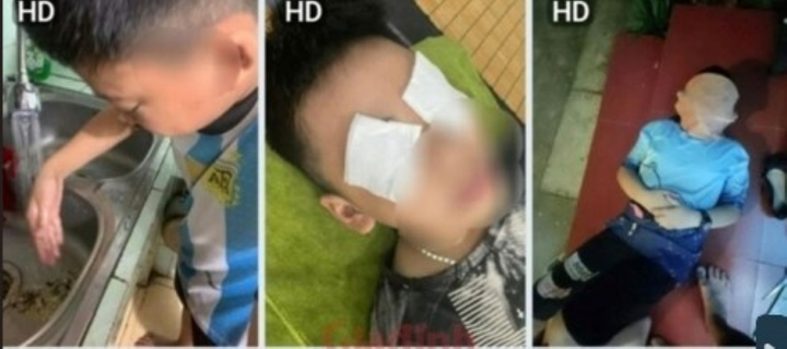 Làm rõ nguyên nhân hàng loạt học sinh ở một trường tiểu học tại Hà Nội bị dị ứng