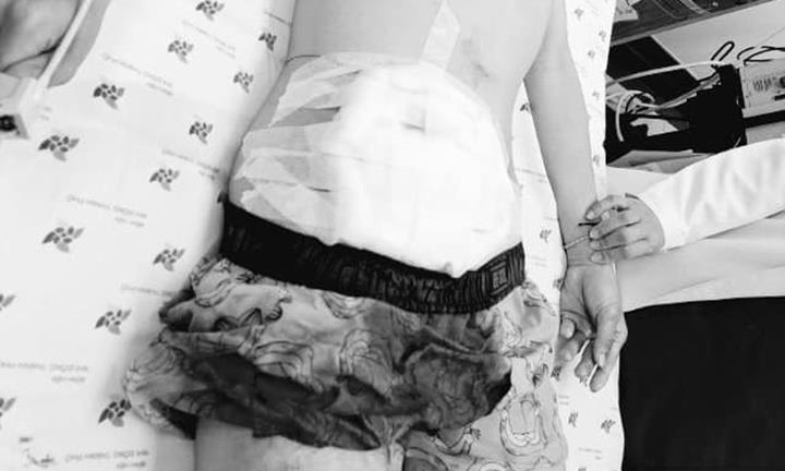 Mâu thuẫn với bạn trong quán cà phê, nam sinh 15 tuổi bị đâm trọng thương