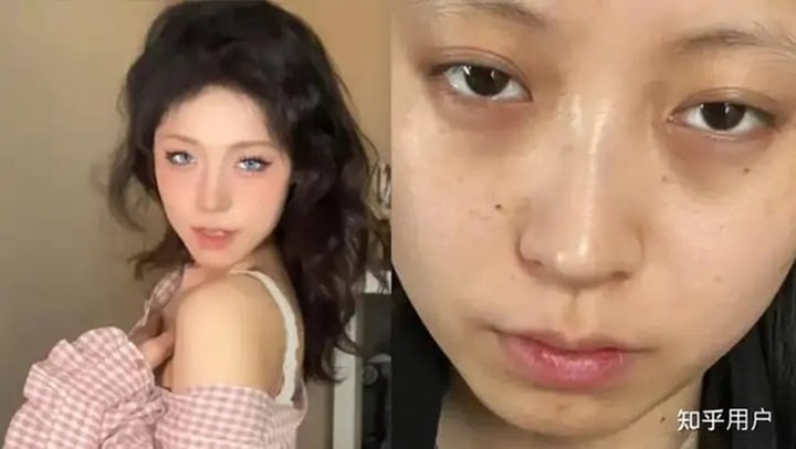 Ngoại hình xuống sắc sau 1 năm đi làm, cô gái được công ty bồi thường hơn 30 triệu đồng để làm đẹp