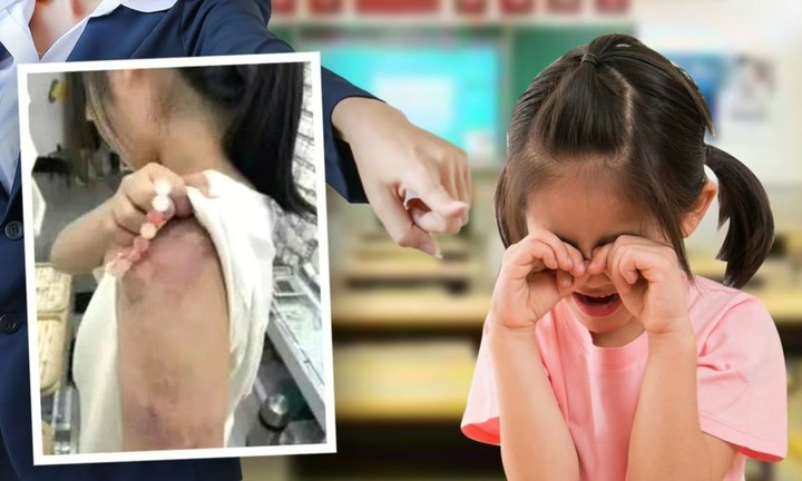 Cô giáo đánh học sinh bầm tay, phụ huynh trong lớp phản ứng gây phẫn nộ