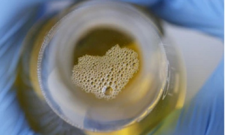 Xuất hiện dấu hiệu này vào buổi sáng, có thể thận bạn đang gặp nguy hiểm