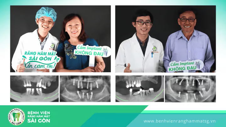 Trồng răng implant có đau không? Khi nào hết đau?