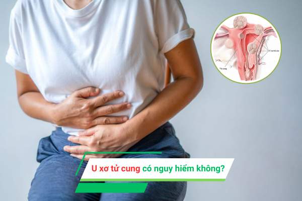 U xơ tử cung có nguy hiểm không? 