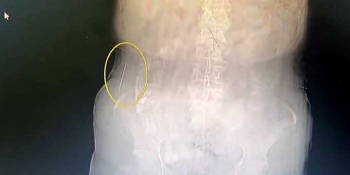 Video: Phát hiện