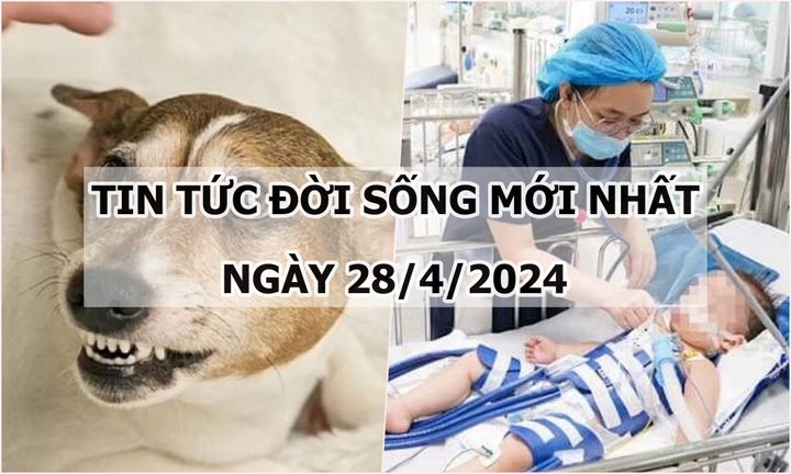 Tin tức đời sống ngày 28/4/2024: Bé 5 tuổi bị chó cắn khi sang nhà bác chơi
