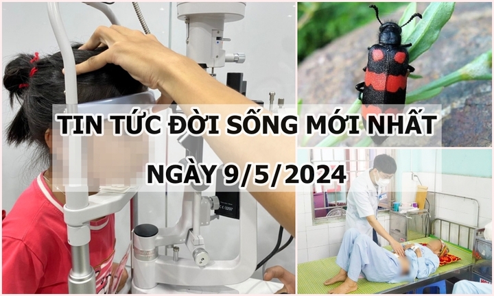 Tin tức đời sống ngày 9/5/2024: Rận mi chi chít trên mí mắt bé gái 5 tuổi