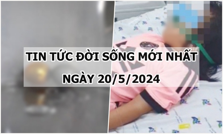 Tin tức đời sống ngày 20/5/2024: Trẻ bị thủng ruột vì vô tình nuốt bi nam châm