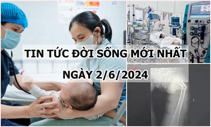 Tin tức đời sống ngày 2/6/2024: Bị gãy xương đùi trong cơn ho dữ dội