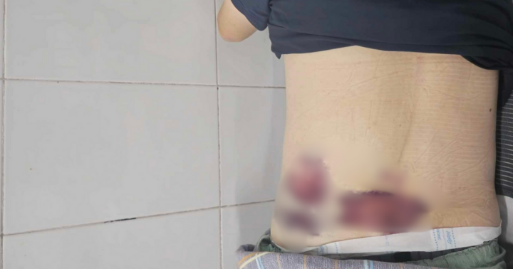 Mâu thuẫn chỗ đỗ xe, người đàn ông ở Quảng Ninh bị đánh nhập viện