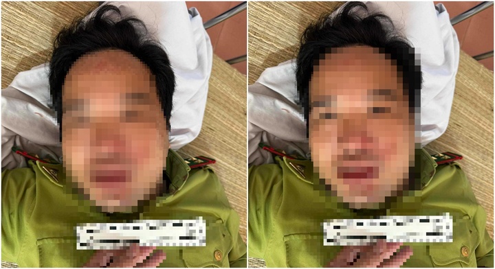 Trạm trưởng kiểm lâm tại Thanh Hóa bị xe tải đâm, công an vào cuộc làm rõ