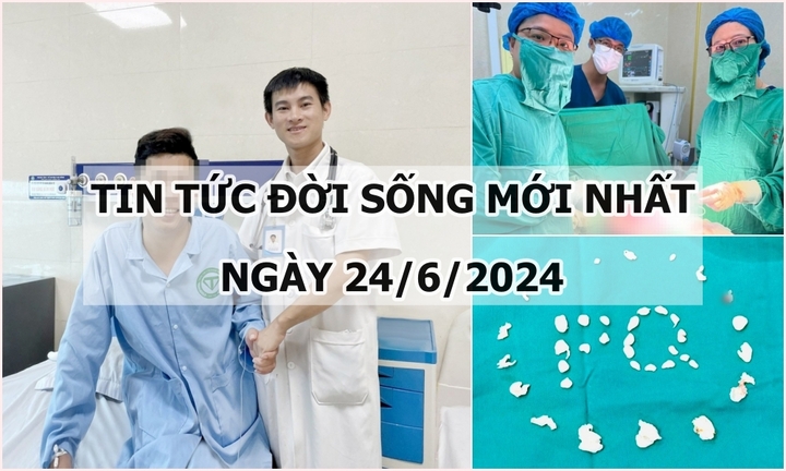 Tin tức đời sống ngày 24/6/2024: Phát hiện hơn 200 viên sỏi trong khớp vai