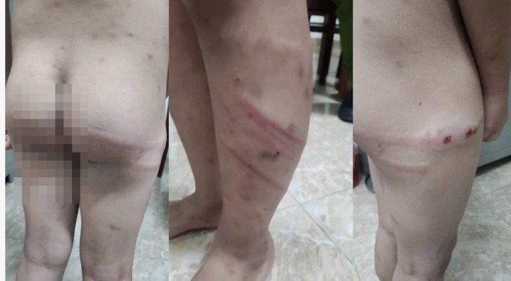 Bất ngờ lời khai của người mẹ cùng người tình bạo hành con trai 11 tuổi