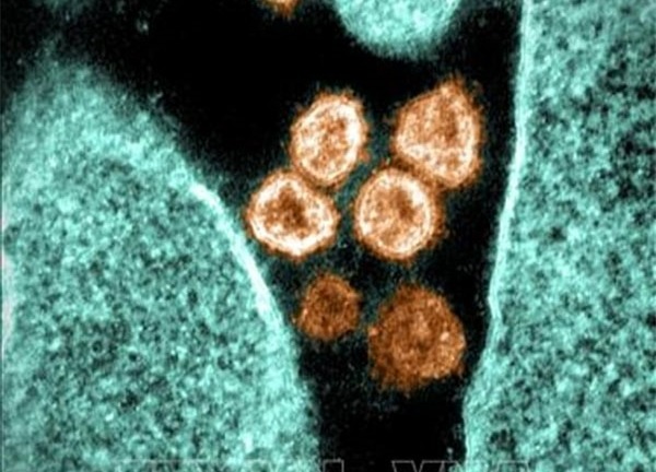 Rò rỉ báo cáo của WHO về điều tra nguồn gốc SARS-CoV-2