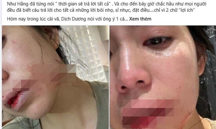Cận cảnh hình ảnh Hằng Du mục bị chồng Trung Quốc 