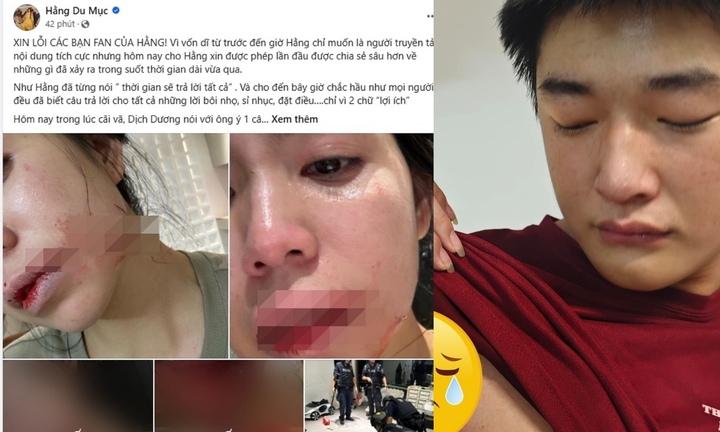 Toàn cảnh vụ Hằng Du Mục bị chồng đánh đập dã man, Dịch Dương bị thương vì lao vào bảo vệ