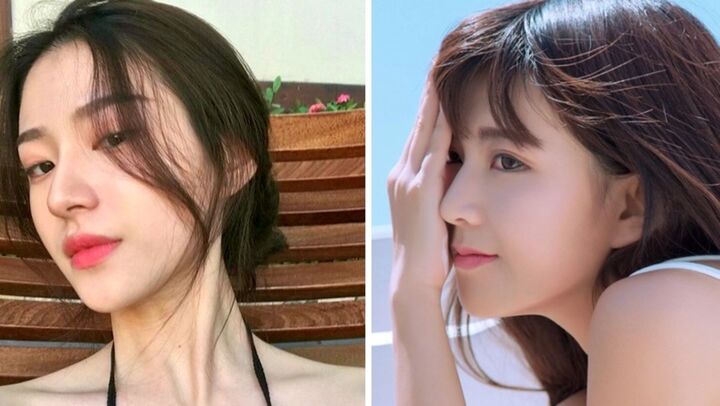 Nếu thuộc nhóm người sau đây, tuyệt đối không nên nâng mũi