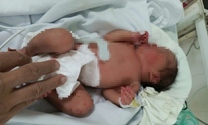 Xót xa bé gái 3 ngày tuổi còn nguyên dây rốn bị bỏ rơi bên đường, cơ thể chi chít vết côn trùng cắn