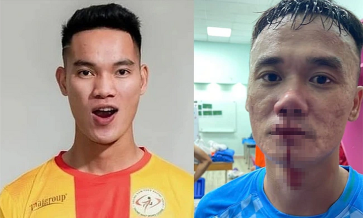 Hai cầu thủ đánh nhau ở giải hạng Nhất nhận án phạt nghiêm khắc từ Ban kỷ luật VFF