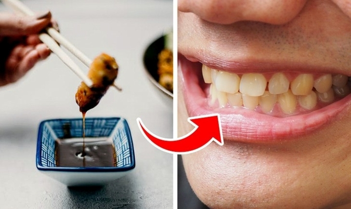 Thói quen khiến răng bị ố vàng