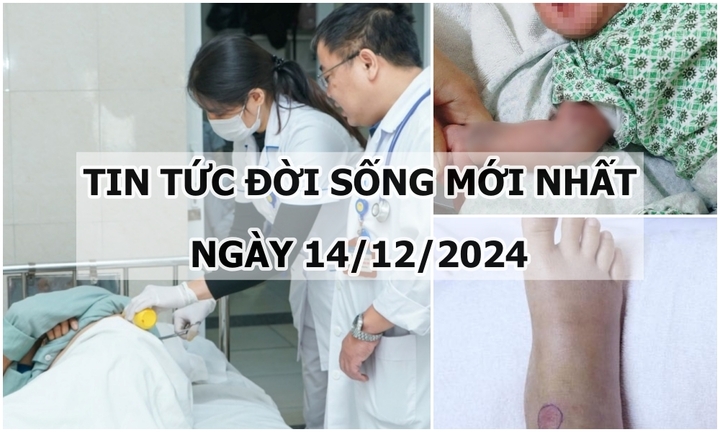 Tin tức đời sống 14/12: Chân sưng nề sau khi chữa rắn cắn theo lời thầy lang