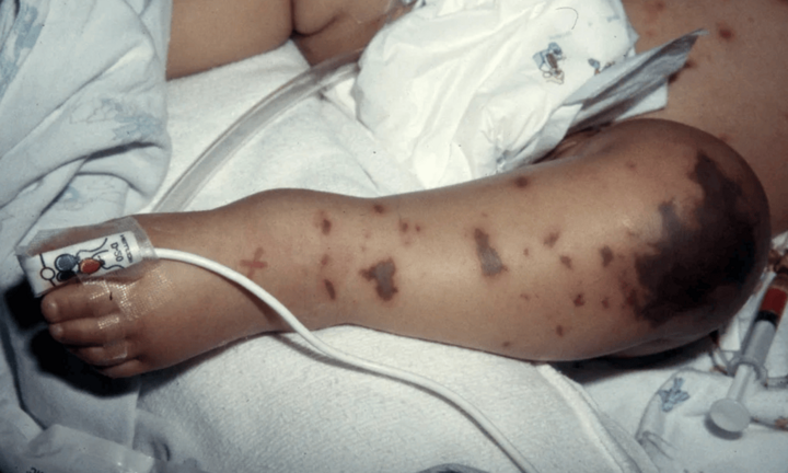 GSK đồng hành cùng Hội Y học Dự phòng tại hội thảo ra mắt sách dự phòng bệnh do não mô cầu ở Việt Nam