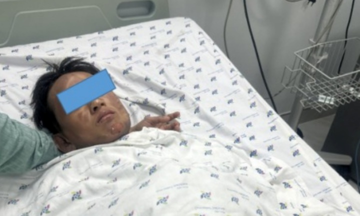 Đốt cồn với lúa làm cốm nổ, bé trai 12 tuổi bỏng nặng