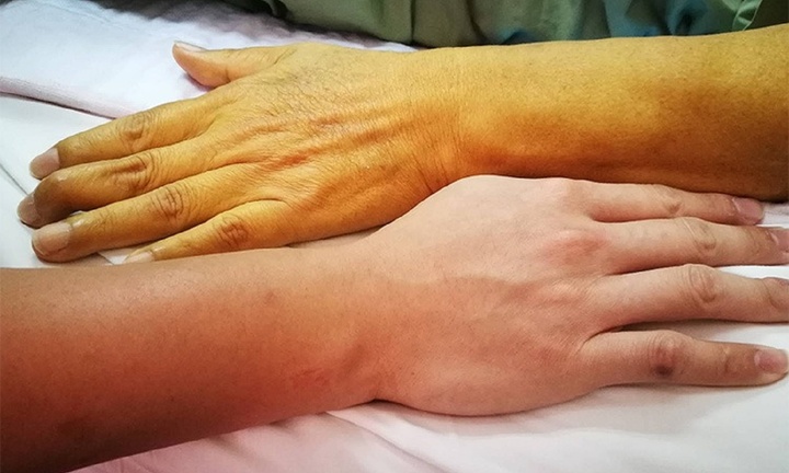 Hai thói quen của nam giới vào buổi sáng gây hại gan hơn cả uống rượu