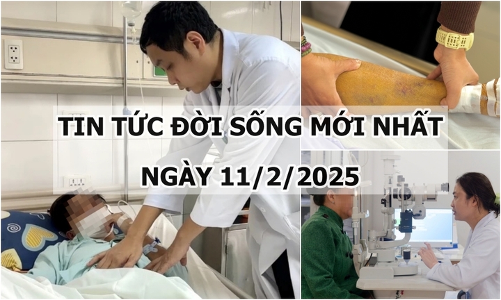 Tin tức đời sống 11/2: Hoảng loạn vào viện sau tiếng nổ “bụp” bên trong mắt