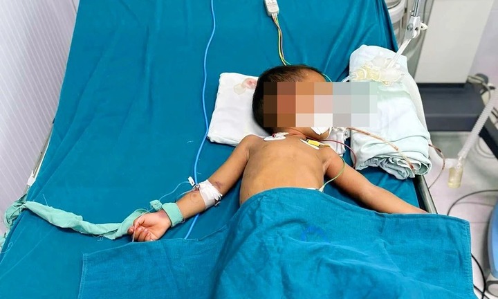 Bé trai bị rối loạn đông máu, xuất huyết não sau khi rắn lục đuôi đỏ cắn