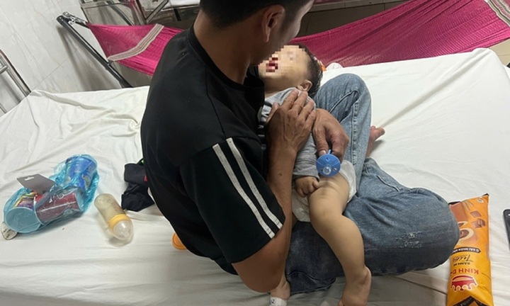 Xác minh thông tin bé gái 9 tháng tuổi ở Đắk Lắk nghi bị đánh bầm má tại điểm giữ trẻ