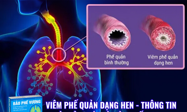 Viêm phế quản dạng hen: Nguyên nhân, triệu chứng, biến chứng và giải pháp cải thiện hiệu quả