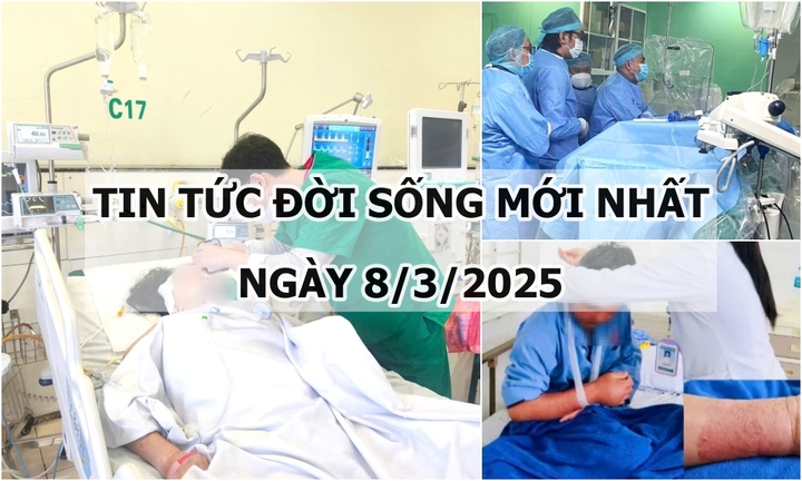 Tin tức đời sống 8/3: Phẫu thuật giữa đêm khuya cứu người phụ nữ bị xuất huyết não