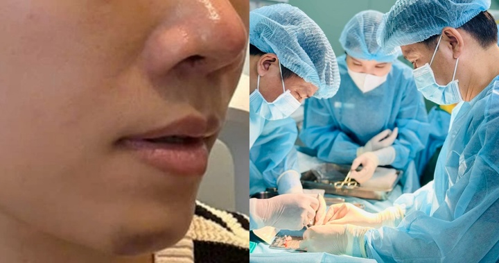 Bi hài hậu vận sau thẩm mỹ: 7 lần đụng đến dao kéo trong 6 tháng, người phụ nữ nhận cái kết đắng