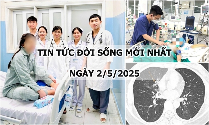 Tin tức đời sống 2/5: Cô gái bị sốc phản vệ nặng khi đang phẫu thuật nâng mũi