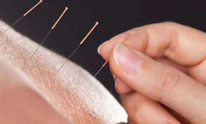 Trung Quốc: Người đàn ông phải cắt một chân sau khi đi châm cứu