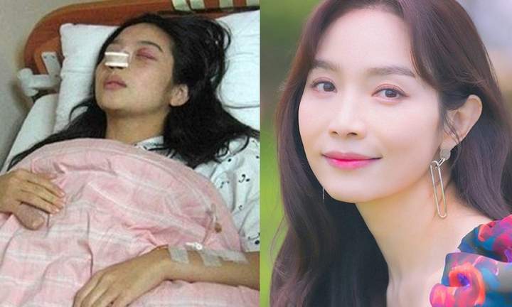 Nữ diễn viên bị chồng đánh đập tàn nhẫn tới sảy thai, ly hôn sau 12 ngày đám cưới giờ ra sao?