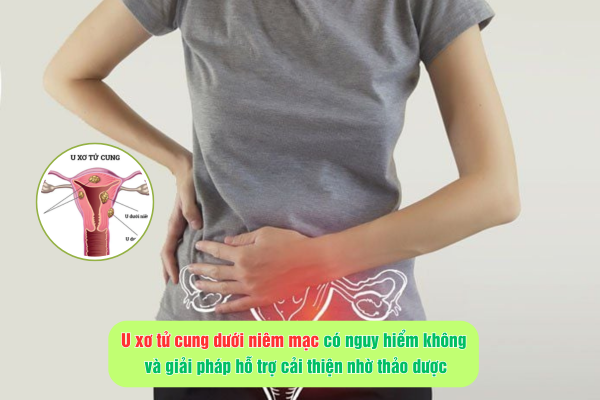 Thông tin về u xơ tử cung dưới niêm mạc và giải pháp hỗ trợ cải thiện nhờ thảo dược